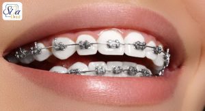 بهترین دندانپزشک متخصص ارتودنسی
