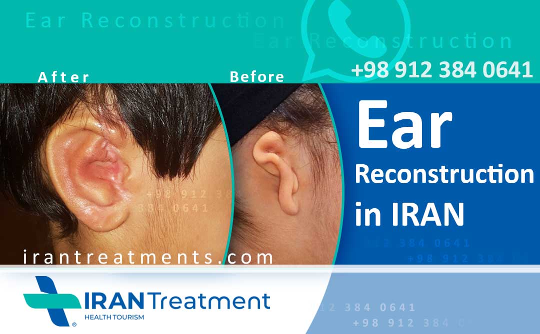 عمل جراحی بازسازی گوش در ایران
